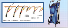 廣州脫毛儀器價格，脫毛一次多少錢，用什么儀器比較好？