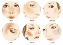 遼寧沈陽(yáng)大連超皮秒價(jià)格，遼寧沈陽(yáng)大連超皮秒廠家，超皮秒祛斑效果怎么樣？