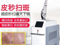 賽諾秀蜂窩皮秒機器多少錢一臺？755超皮秒機器設(shè)備價格報價