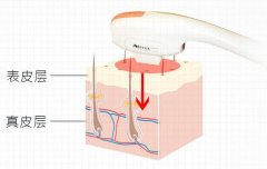 ?牛奶光機(jī)器多少錢一臺(tái)？?牛奶光價(jià)格報(bào)價(jià)_?牛奶光設(shè)備多少錢