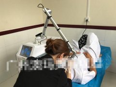 皮秒祛斑項目合作哪家口碑比較好？澳瑪祛斑項目合作_祛斑解決方案