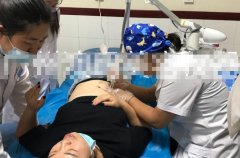 點陣激光設備哪個牌子好？國產(chǎn)點陣激光儀器_co2點陣激光治療儀品牌